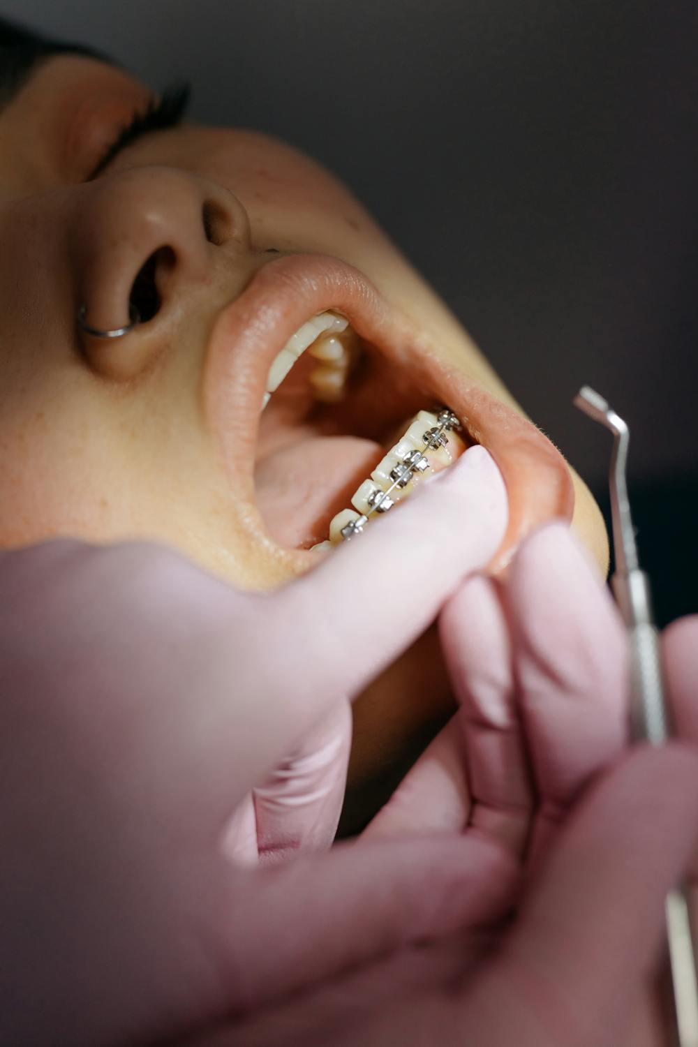 Periodoncia